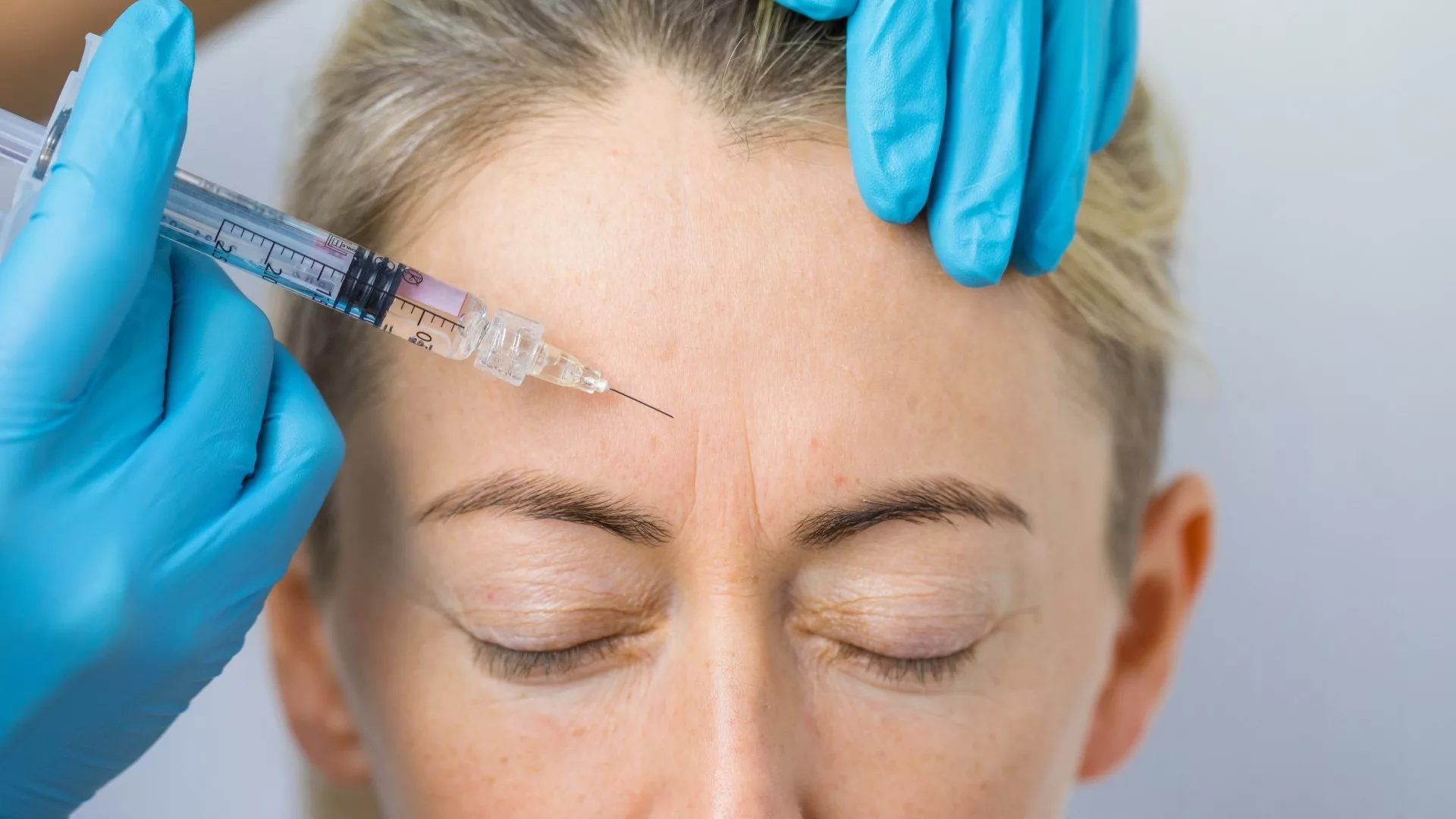 how long do anti wrinkle injections last